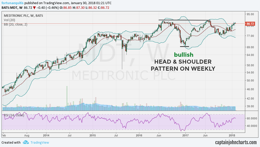 Mdt Stock Chart